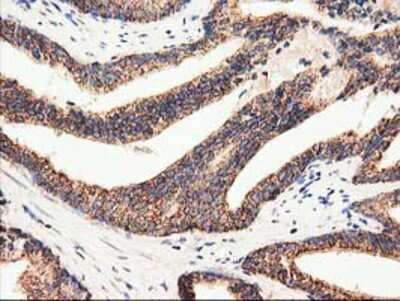 Immunohistochemistry-Paraffin: CLPP Antibody (OTI1F6) [NBP2-03323]