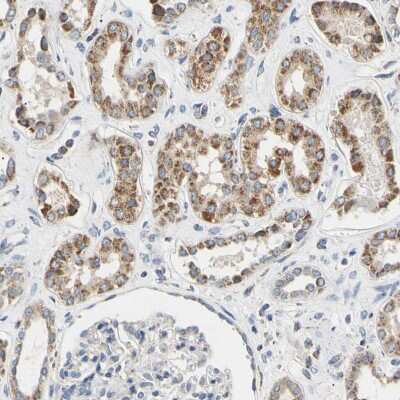 Immunohistochemistry-Paraffin: CLPP Antibody [NBP1-89557]