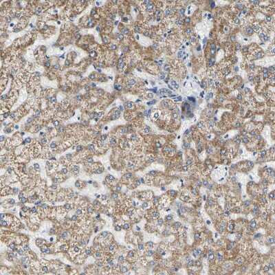 Immunohistochemistry-Paraffin: CLPP Antibody [NBP1-89557]