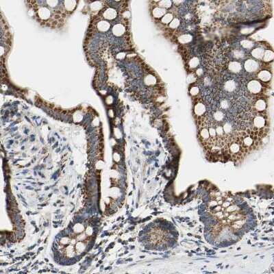 Immunohistochemistry-Paraffin: CLPP Antibody [NBP1-89557]