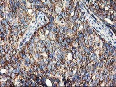 Immunohistochemistry: CLPP Antibody (OTI1F6) - Azide and BSA Free [NBP2-71363]