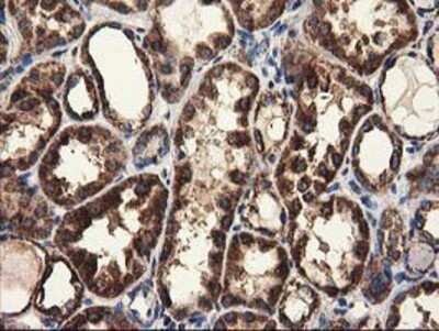 Immunohistochemistry: CLPP Antibody (OTI1F6) - Azide and BSA Free [NBP2-71363]