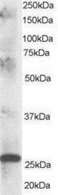 Western Blot: CLPP Antibody [NB100-1189]