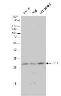 Western Blot: CLPP Antibody [NBP1-31011]