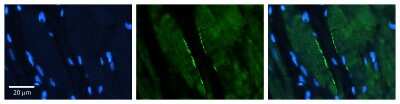 Immunohistochemistry: CLPTM1L Antibody [NBP1-62477]