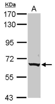 Western Blot: CLPTM1L Antibody [NBP2-15920]