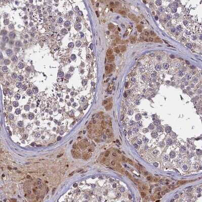 Immunohistochemistry-Paraffin: CLRN2 Antibody [NBP1-90967]