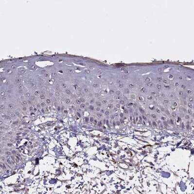 Immunohistochemistry-Paraffin: CLRN2 Antibody [NBP1-90967]