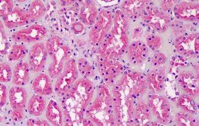 Immunohistochemistry-Paraffin: CLS1 Antibody [NBP2-27464]