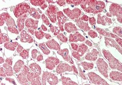 Immunohistochemistry-Paraffin: CLS1 Antibody [NBP2-83976]
