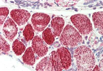 Immunohistochemistry-Paraffin: CLS1 Antibody [NBP2-83976]