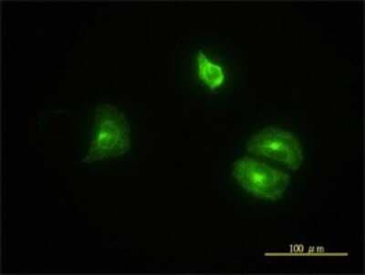 Immunocytochemistry/ Immunofluorescence: CLTB Antibody (4B12-1E3) [H00001212-M01]