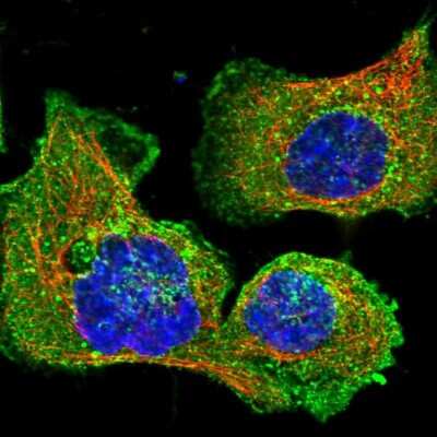 Immunocytochemistry/ Immunofluorescence: CLTB Antibody [NBP2-55390]