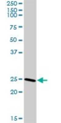 Western Blot: CLTB Antibody [H00001212-D01P]