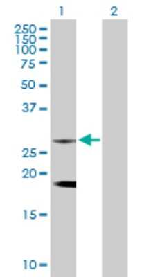 Western Blot: CLTB Antibody [H00001212-D01P]