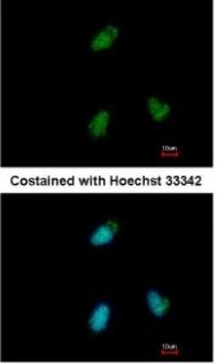 Immunocytochemistry/ Immunofluorescence: CLUAP1 Antibody [NBP1-31778]