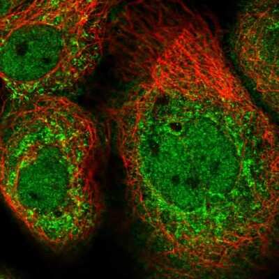 Immunocytochemistry/ Immunofluorescence: CLUAP1 Antibody [NBP2-58124]
