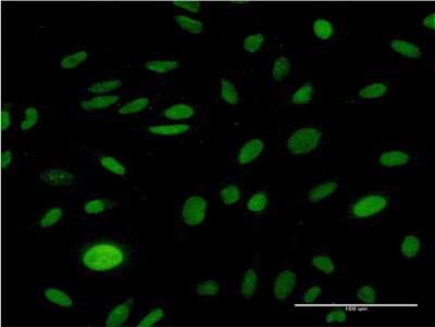 Immunocytochemistry/ Immunofluorescence: CMAS Antibody (2E1) [H00055907-M05]