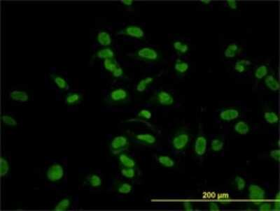 Immunocytochemistry/ Immunofluorescence: CMAS Antibody (5A2) [H00055907-M01]