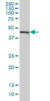 Western Blot: CMAS Antibody (5A2) [H00055907-M01]