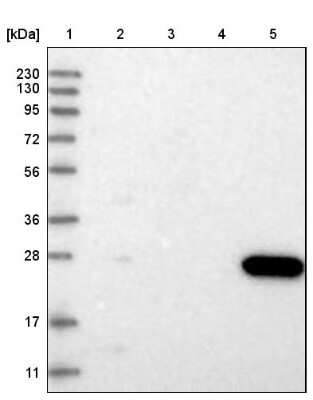 Western Blot: CMBL Antibody [NBP1-82069]
