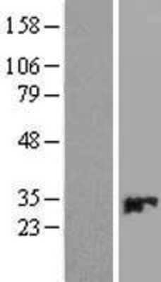 Western Blot: CMBL Overexpression Lysate [NBL1-09295]