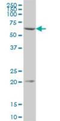 Western Blot: CMG-2/ANTXR2 Antibody [H00118429-B01P]
