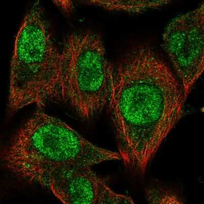Immunocytochemistry/ Immunofluorescence: CMIP Antibody [NBP2-58180]