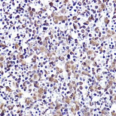 Immunohistochemistry-Paraffin: CMIP Antibody - Azide and BSA Free [NBP3-16024]