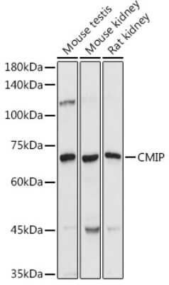 Western Blot: CMIP AntibodyAzide and BSA Free [NBP3-16024]