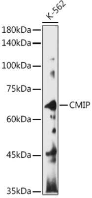 Western Blot: CMIP AntibodyAzide and BSA Free [NBP3-16024]
