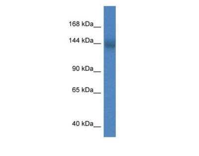 Western Blot: CMIP2 Antibody [NBP3-06878]