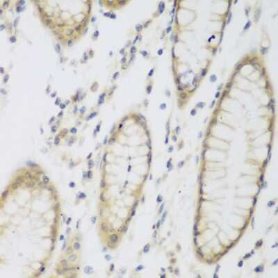Immunohistochemistry-Paraffin: CML2 Antibody - BSA Free [NBP2-92803]