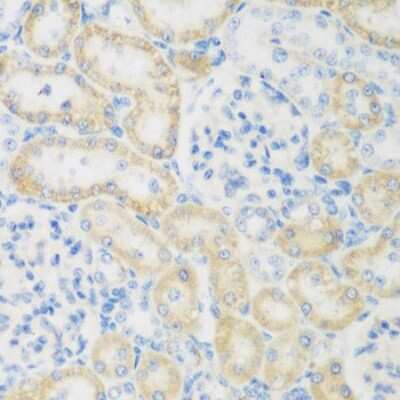 Immunohistochemistry-Paraffin: CML2 Antibody - BSA Free [NBP2-92803]