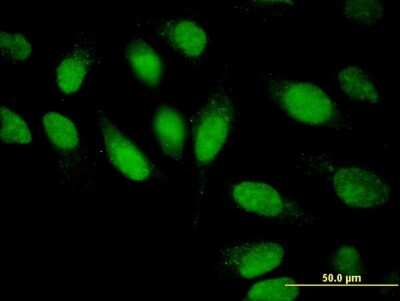 Immunocytochemistry/ Immunofluorescence: CMP kinase Antibody (1D7) [H00051727-M03]