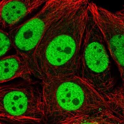 Immunocytochemistry/ Immunofluorescence: CMP kinase Antibody [NBP2-33692]