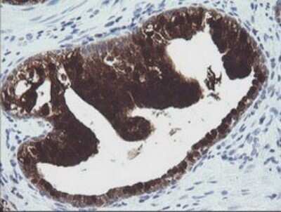 Immunohistochemistry: CMP kinase Antibody (OTI1A1) - Azide and BSA Free [NBP2-71947]