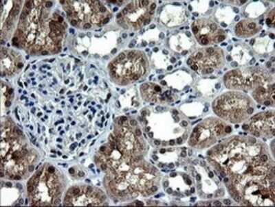 Immunohistochemistry: CMP kinase Antibody (OTI1A1) [NBP2-46313]