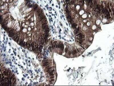 Immunohistochemistry: CMP kinase Antibody (OTI1A1) [NBP2-46313]