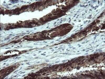 Immunohistochemistry: CMP kinase Antibody (OTI1A1) [NBP2-46313]