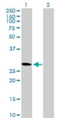 Western Blot: CMTM2 Antibody [H00146225-B01P]