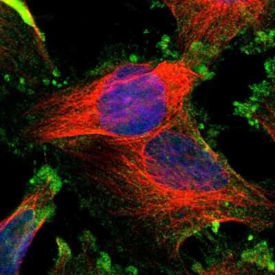 Immunocytochemistry/ Immunofluorescence: CMTM4 Antibody [NBP1-84457]