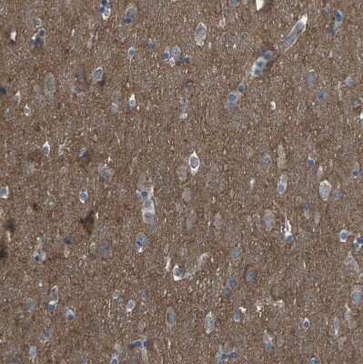 Immunohistochemistry-Paraffin: CMTM4 Antibody [NBP1-84457]