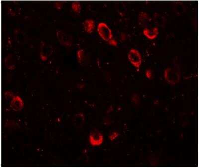 Immunohistochemistry: CMYA5 Antibody - BSA Free [NBP1-77117]