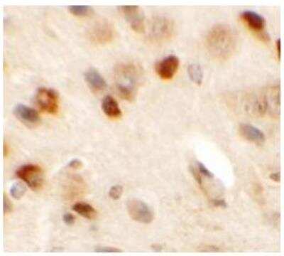 Immunohistochemistry: CMYA5 Antibody - BSA Free [NBP1-77117]