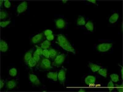Immunocytochemistry/ Immunofluorescence: CNAP1 Antibody (4C12) [H00009918-M01]