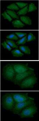 Immunocytochemistry/ Immunofluorescence: CNBP Antibody (38F10) - BSA Free [NBP2-42632]