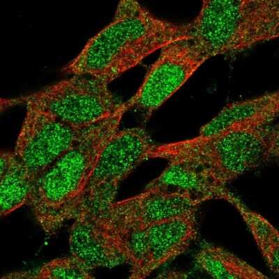 Immunocytochemistry/ Immunofluorescence: CNBP Antibody [NBP2-55690]