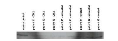 Western Blot: CNBP Antibody [NBP2-87197]
