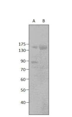 Western Blot: CNGB1 Antibody [NBP3-12461]